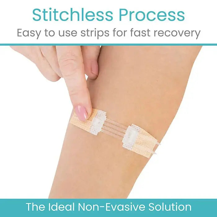 Wound Closure Kit (Sterile) - SupplyingSeniors.com