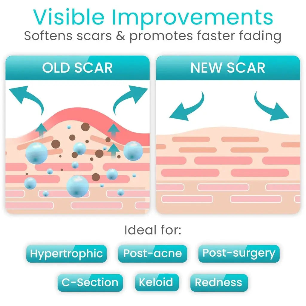 Silicone Scar Tape SupplyingSeniors.com