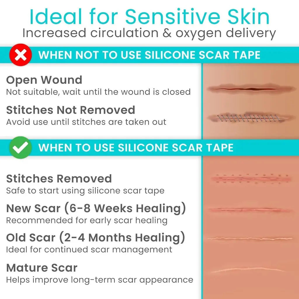 Silicone Scar Tape SupplyingSeniors.com