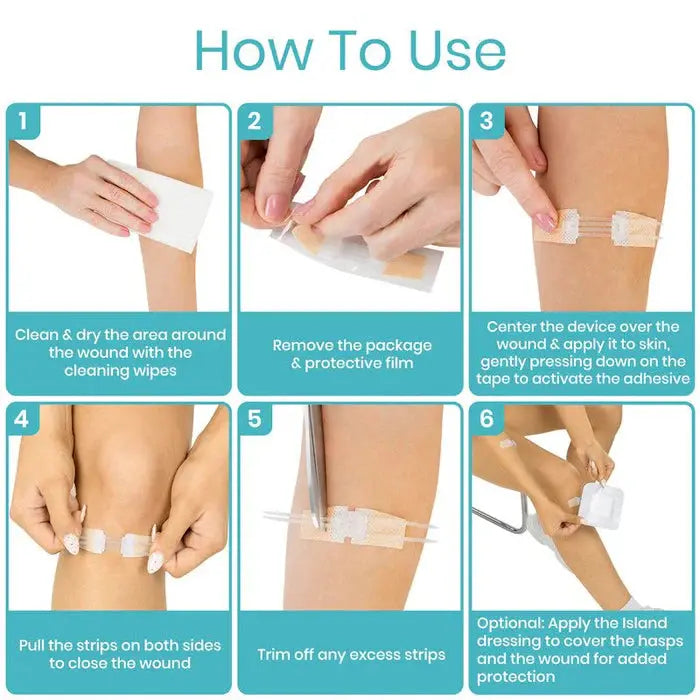 Wound Closure Kit (Sterile) - SupplyingSeniors.com